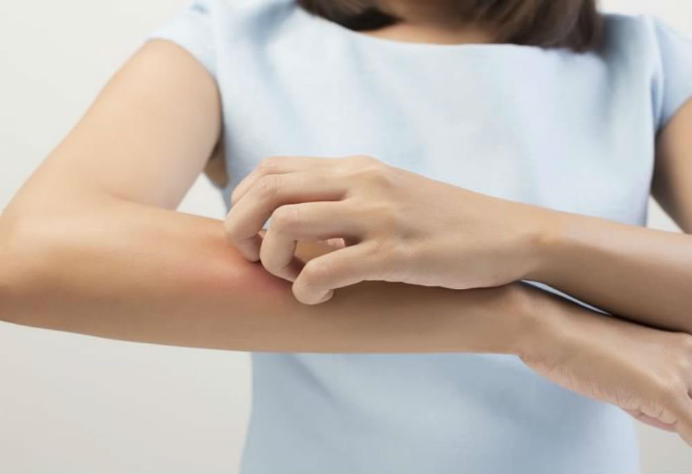 SOY ALÉRGICA AL SEXO